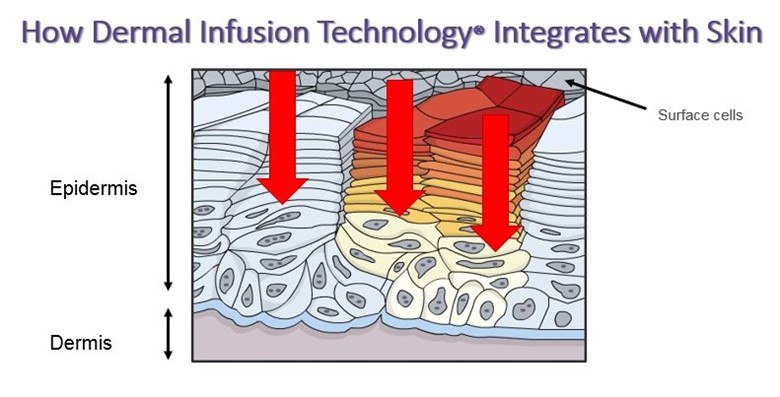 Footlogix Pediceutical Dermal Infusion Technology